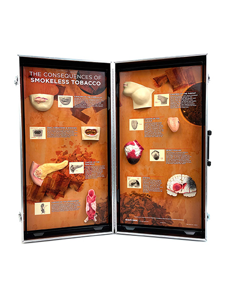 Smokeless Tobacco Consequences 3-D Display