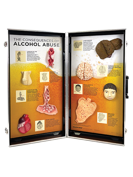 Alcohol Abuse Consequences 3-D Display