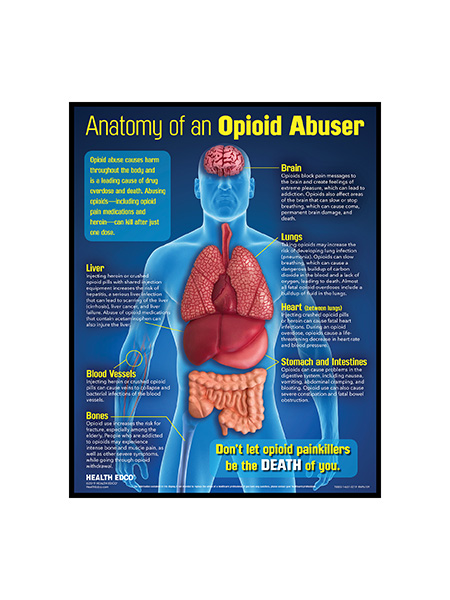 Anatomy of an Opioid Abuser 3-D Display