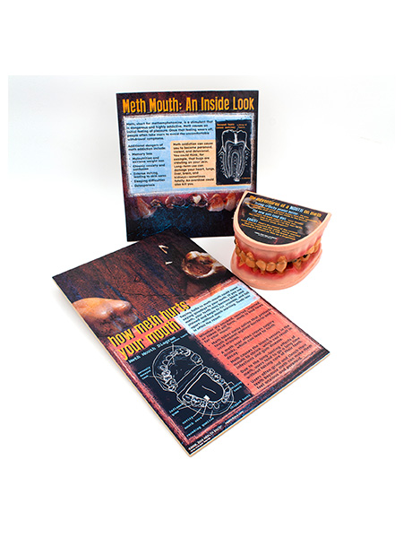 Meth Mouth: An Inside Look Display