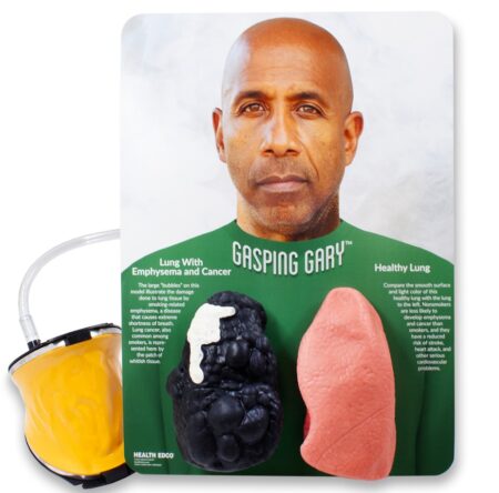 Gasping Gary Smoker's Lungs Comparison Model